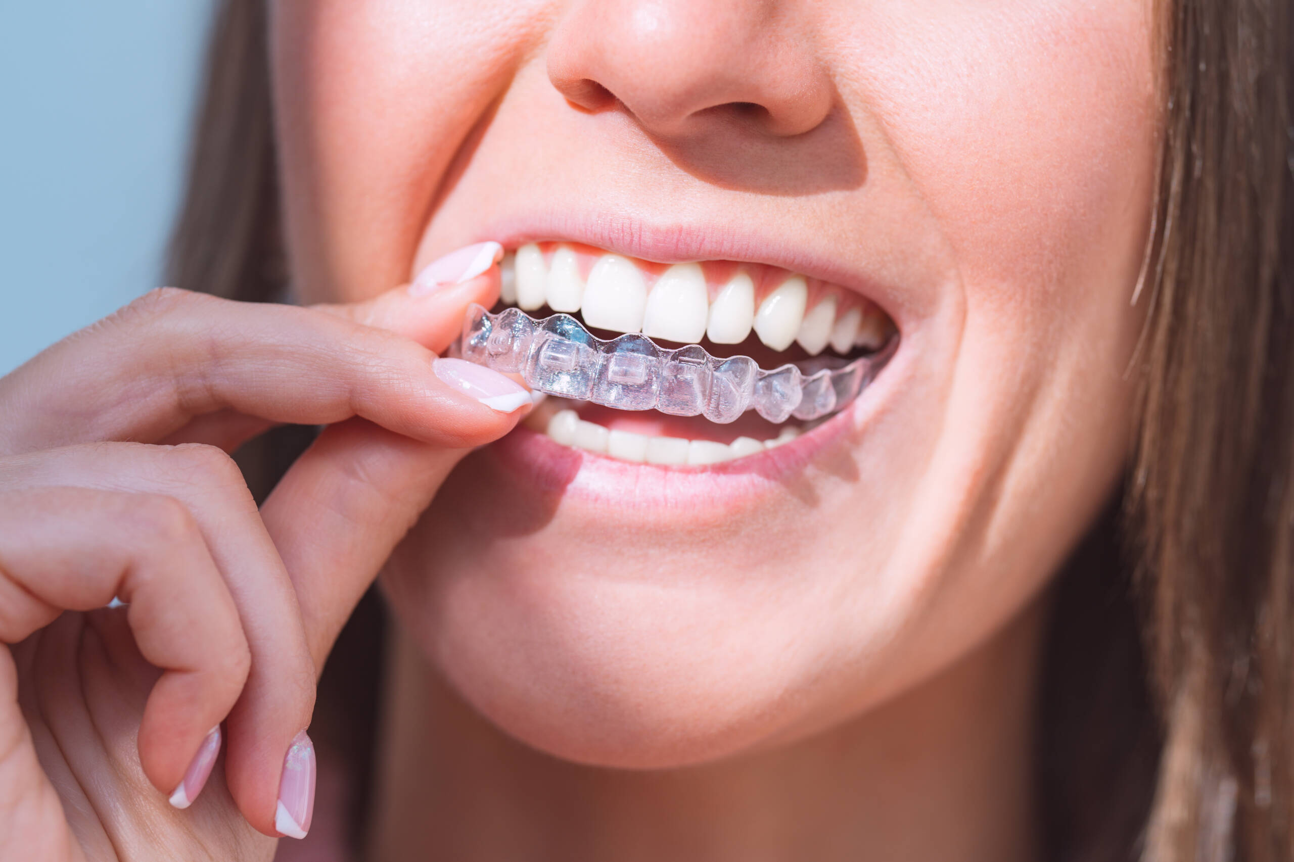 woman-with-perfect-smile-wearing-invisible-dental-aligners-dental-correction