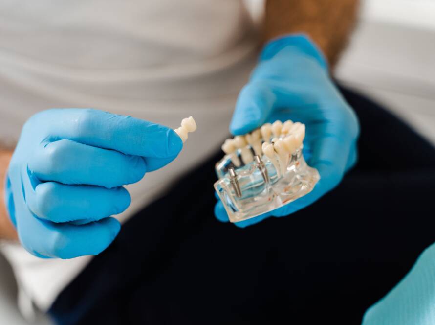 Implantologia a carico immediato