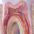 Devitalizzazione o estrazione dentale: quale scegliere?